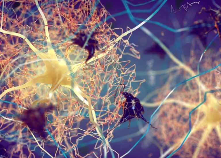 A tumor-secreted protein alleviates Alzheimer’s disease pathology
