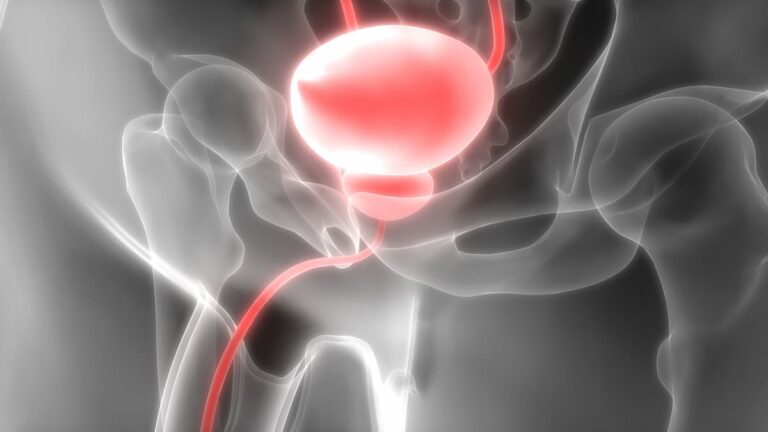 Men With Learning Disabilities Experience Worse Prostate Cancer Outcomes scout