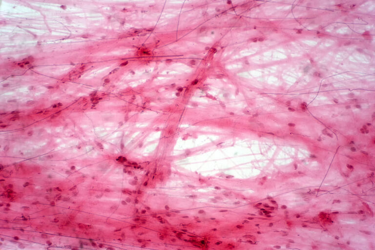 Surviving in the matrix - Cancer Research UK