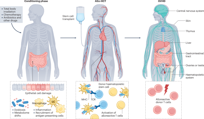 The intestinal microbiota as a key modulator of acute graft-versus-host disease The intestinal microbiota as a key modulator of acute graft-versus-host disease