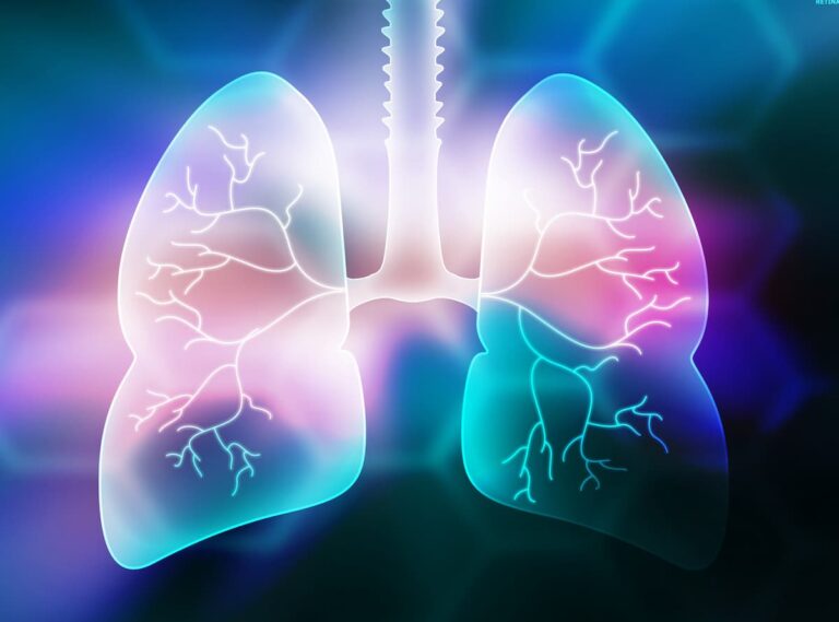Bevacizumab Biosimilar Shows Clinical Equivalence in Advanced NSCLC Medical Crossfireยฎ: Expert Perspectives on Targeting c-Met Overexpression and ๐๐๐ Genomic Alterations in NSCLC โ Unveiling the Complexities of ๐๐๐ Dysregulation