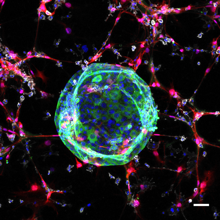 Cancer Research UK partners with the Royal College of Surgeons of England to help people with rectal cancer avoid unnecessary surgery - Cancer Research UK