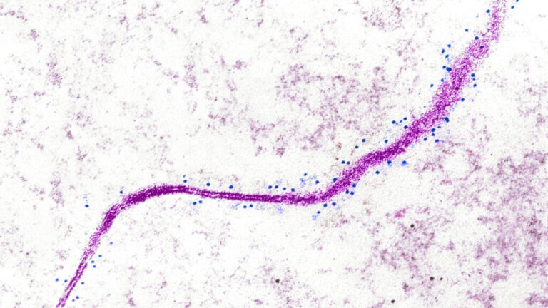 Cancer researchers identify potential new target for solid tumors