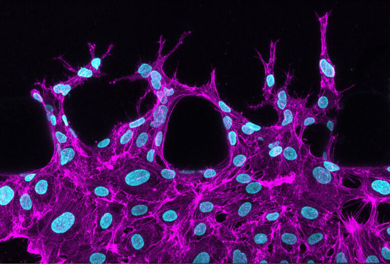 Latest winner in our Research is Beautiful competition - Cancer Research UK