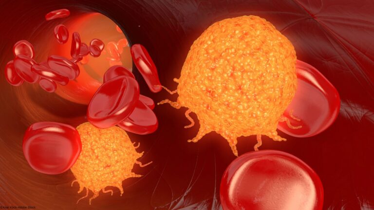 Mipletamig Combo Produces Robust Activity in Newly Diagnosed AML scout