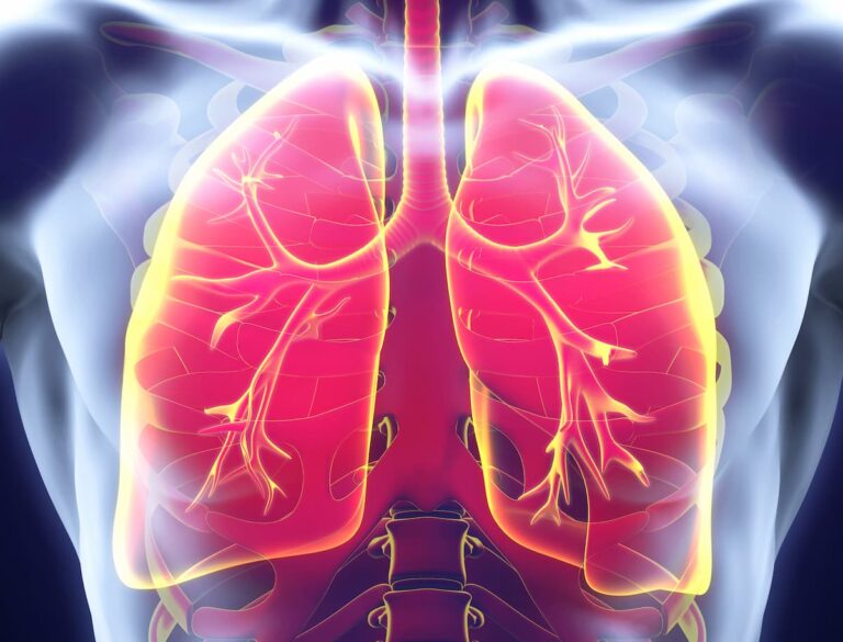 Community Oncology Connections™: Beyond Primary End Points – Digging Into Randomized and Real-World Data to Guide Challenging Treatment Decisions in HR+/HER2− Metastatic Breast Cancer