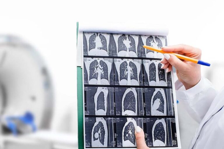 Racial Disparities Persist In Lung Cancer Treatment, Study Finds