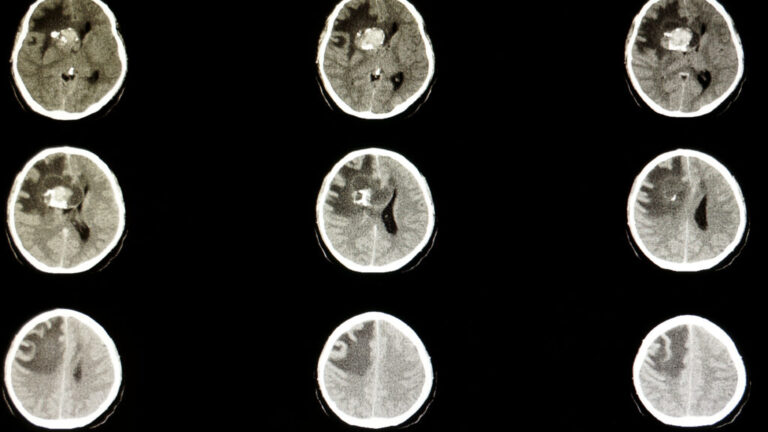 Servier to acquire Day One, maker of pediatric cancer drug, for $2.5B