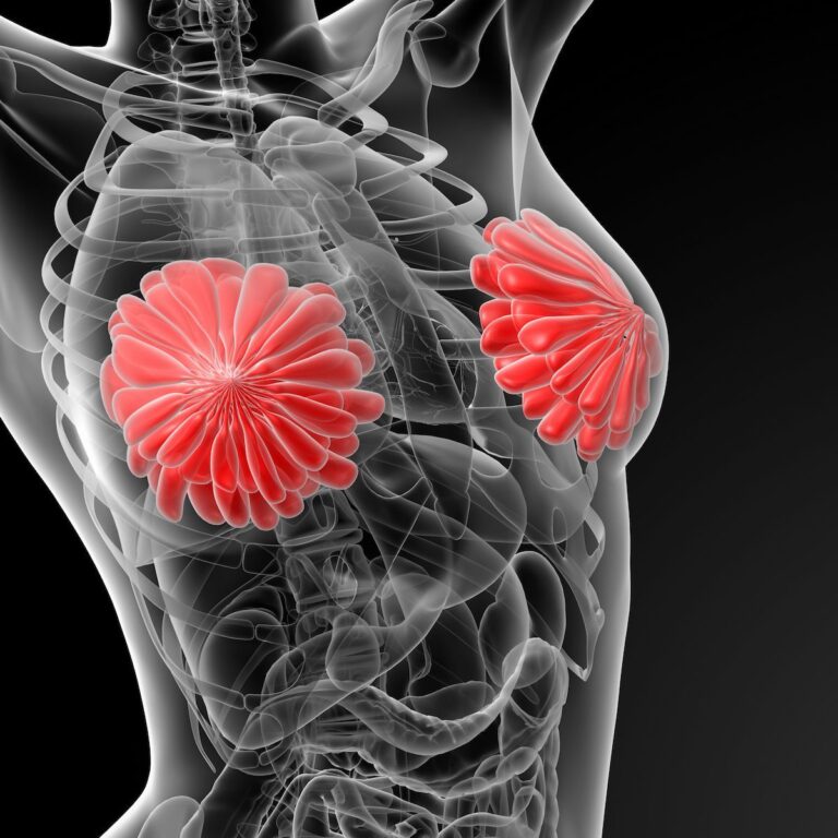 THP Yields Noninferior pCR vs TCbHP in HER2-Positive Early Breast Cancer scout
