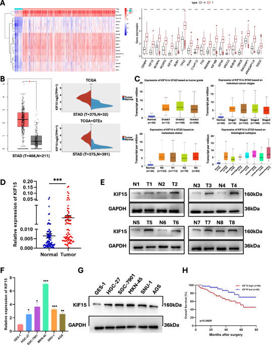 The YY1-KIF15-PRDX1 axis promotes gastric cancer progression by inducing mitochondrial ROS imbalance The YY1-KIF15-PRDX1 axis promotes gastric cancer progression by inducing mitochondrial ROS imbalance