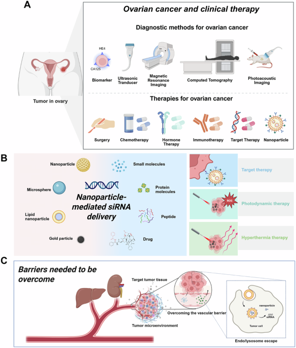 The application of nanoparticle-mediated siRNA delivery systems in ovarian cancer The application of nanoparticle-mediated siRNA delivery systems in ovarian cancer