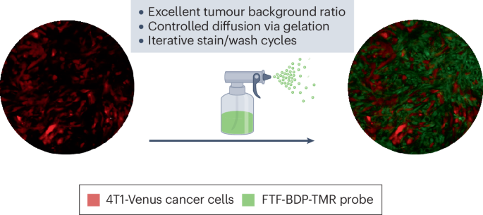 Tumour microenvironment in the surgical spotlight Tumour microenvironment in the surgical spotlight