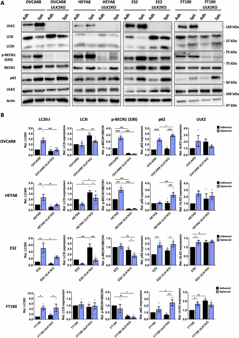 ULK1 promotes metastatic progression in experimental models of epithelial ovarian cancer ULK1 promotes metastatic progression in experimental models of epithelial ovarian cancer