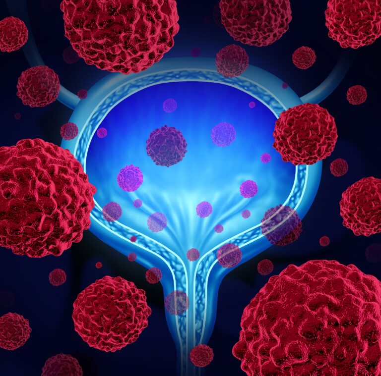 Community Oncology Connections™: Beyond Primary End Points – Digging Into Randomized and Real-World Data to Guide Challenging Treatment Decisions in HR+/HER2− Metastatic Breast Cancer