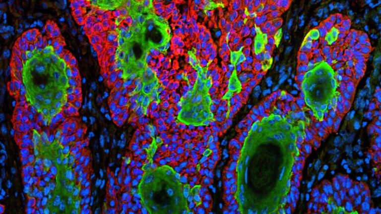 Replimune skin cancer drug that became FDA flashpoint is rejected again Replimune skin cancer drug that became FDA flashpoint is rejected again