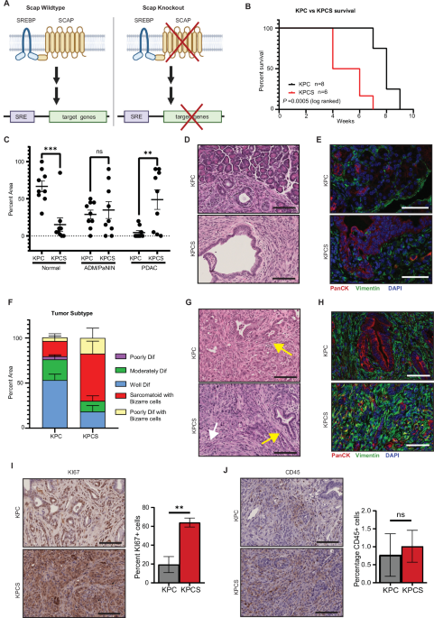 Role of SCAP in regulation of pancreatic homeostasis, pancreatitis, and tumorigenesis Role of SCAP in regulation of pancreatic homeostasis, pancreatitis, and tumorigenesis