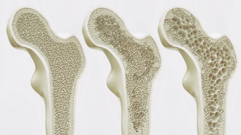 Scientists may have found a way to keep your bones strong for life Scientists may have found a way to keep your bones strong for life