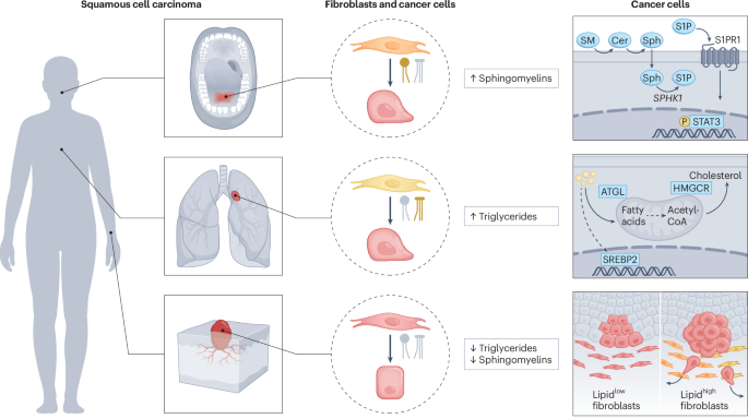 Tissue-trained fibroblasts fuel invasion with lipids Tissue-trained fibroblasts fuel invasion with lipids