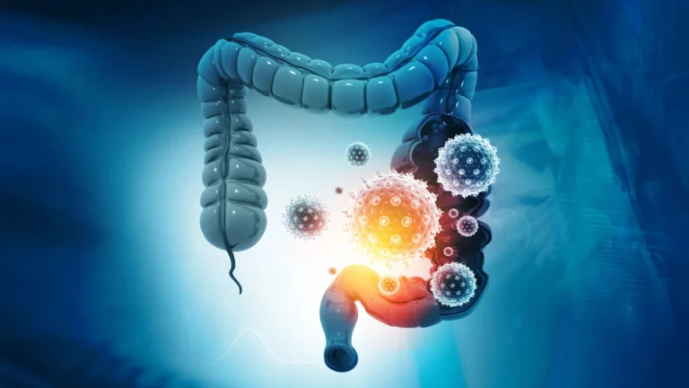 What’s hiding inside colon cancer could change treatment What’s hiding inside colon cancer could change treatment