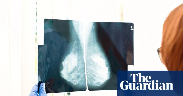 Why routine cancer tests have age limits | Cancer
