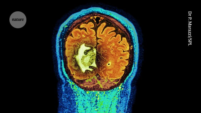 Bespoke DNA vaccine offers hope for treatment of notorious brain cancer