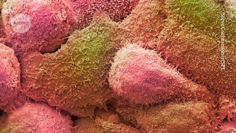 Blood test hints at breast-tumour response to treatment