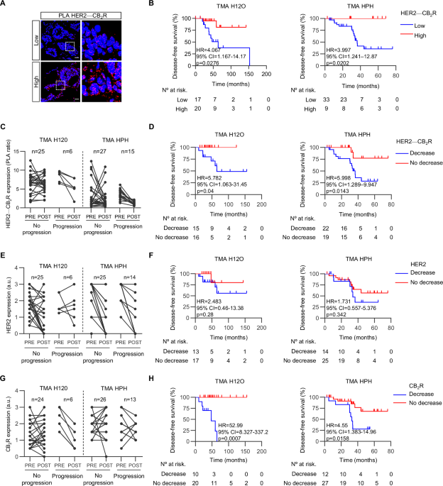 Cannabinoid CB2 receptor drives trastuzumab resistance and predicts durable anti-HER2 response Cannabinoid CB2 receptor drives trastuzumab resistance and predicts durable anti-HER2 response