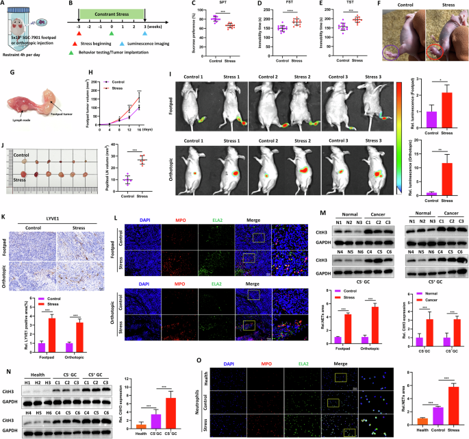 Chronic stress drives gastric cancer lymph node metastasis via NETosis through a feedforward ACh-NGF axis-mediated PKC-γ/STAT3 pathway Chronic stress drives gastric cancer lymph node metastasis via NETosis through a feedforward ACh-NGF axis-mediated PKC-γ/STAT3 pathway