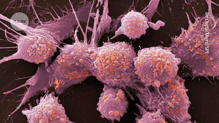 Does the PSA test for prostate cancer save lives? New data reverse gold-standard findings