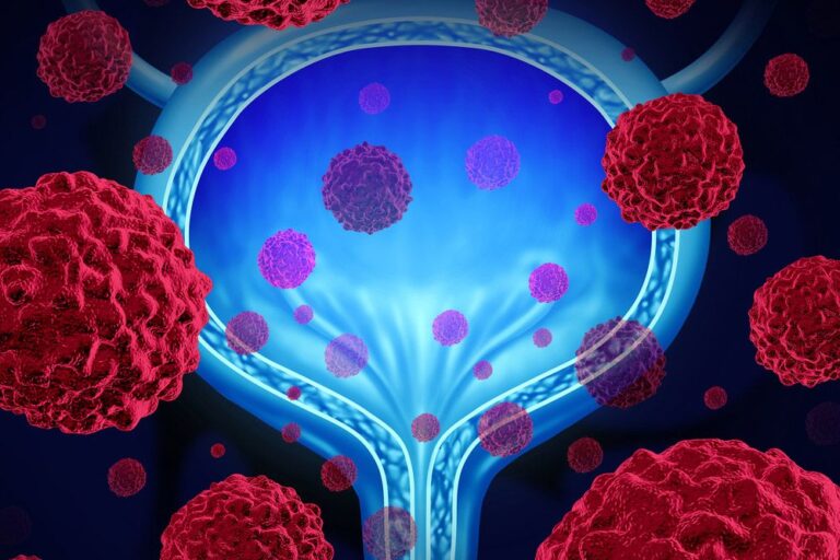 Dabogratinib Shows Early Activity in FGFR3-Altered Low-Grade NMIBC In those with centrally confirmed lymphoma subtypes, the HR for PFS was 0.68, with a 24-month PFS rate of 72.7% vs 62.2% in favor of the tafasitamab combo.