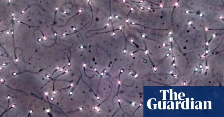 Man produces sperm from testicular tissue frozen as a child in breakthrough trial | Men’s health Man produces sperm from testicular tissue frozen as a child in breakthrough trial | Men's health