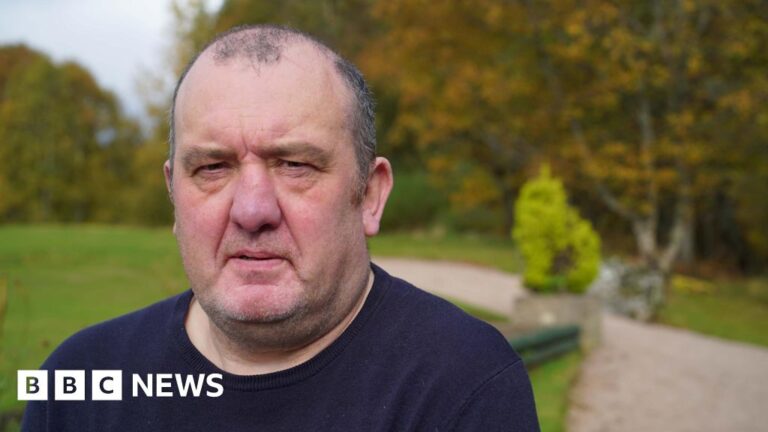 Removing 30% of my penis saved my life - but watching the footage was gruesome
