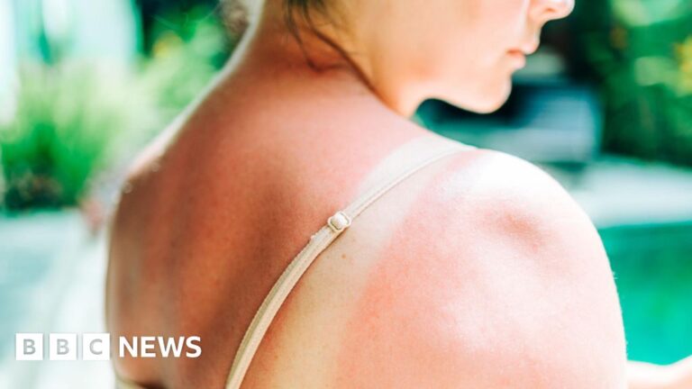 Riskiest skin cancer cases hit UK record high Riskiest skin cancer cases hit UK record high