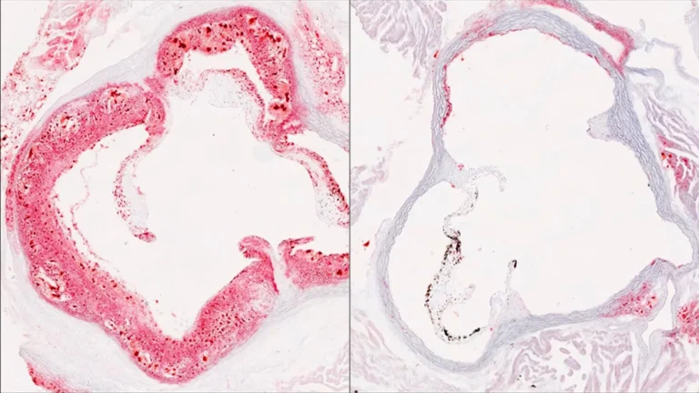 Scientists discover hidden liver switch that cuts harmful cholesterol