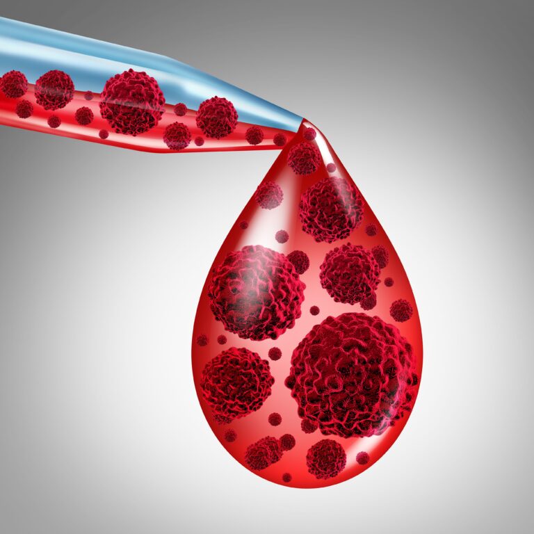 Tafasitamab Combo Prolongs Progression vs R-CHOP Alone in BCL Groups Tafasitamab Combo Prolongs Progression vs R-CHOP Alone in BCL Groups