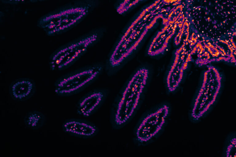The cell keeps the score: ‘memory’, inflammation and bowel cancer – Cancer Research UK The cell keeps the score: 'memory', inflammation and bowel cancer - Cancer Research UK