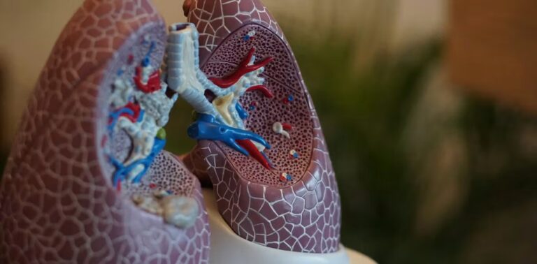 Australia’s lung cancer screening program is a year old. But can the health system deliver? Australia’s lung cancer screening program is a year old. But can the health system deliver?