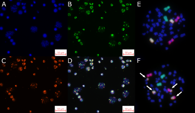 Breast cancer risk genes affecting individual radiosensitivity Breast cancer risk genes affecting individual radiosensitivity