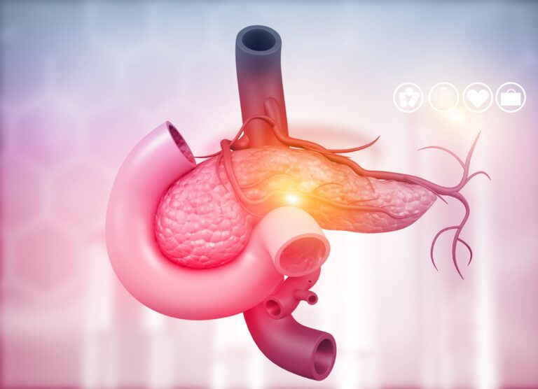 ELI-002 7P Misses Primary End Point in Phase 2 AMPLIFY-7P PDAC Study Cancer cell or cancerous tumor amidst flowing red blood cells in a blood vessel, artery or vein 3D rendering illustration. Medicine, pathology, oncology, disesase, science concepts.