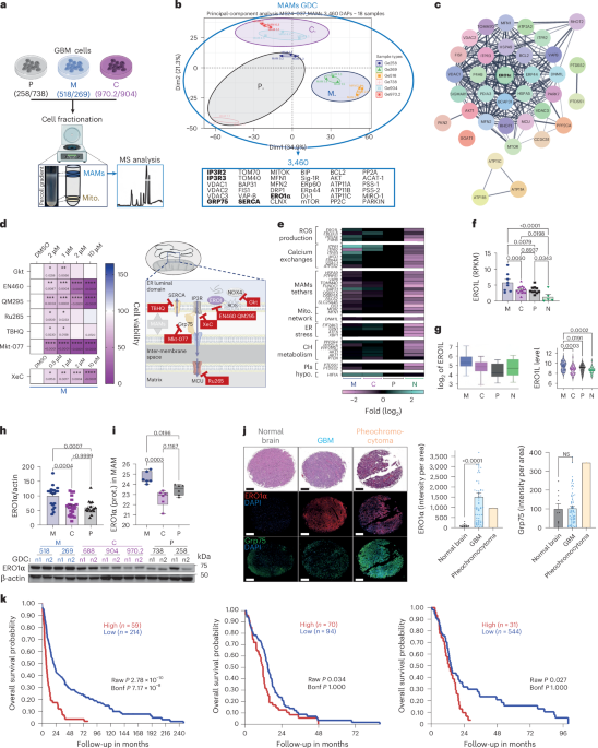 ERO1a fosters glioblastoma aggressiveness and metabolic flexibility by regulating mitochondria-associated membrane dynamics ERO1a fosters glioblastoma aggressiveness and metabolic flexibility by regulating mitochondria-associated membrane dynamics