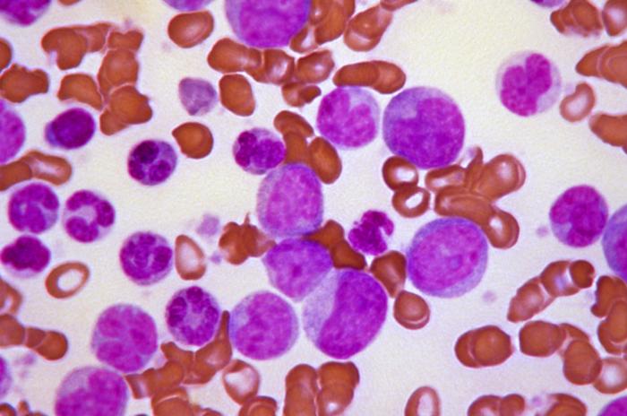 Enliven Therapeutics’ leukemia drug shows promise in new study Enliven Therapeutics' leukemia drug shows promise in new study