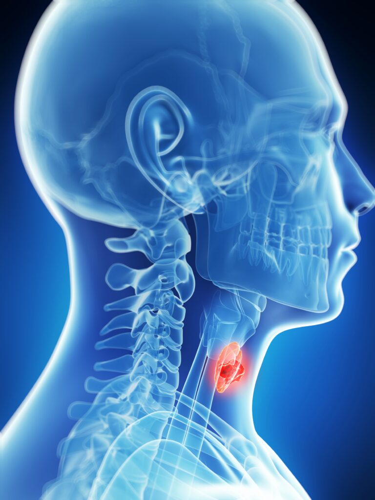 Nivolumab/TMC-I Reduces Risk of Death in Platinum-Sensitive HNSCC A second expansion phase assessing HC-7366/belzutifan in locally advanced/metastatic renal cell carcinoma is ongoing.