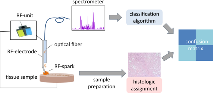 Real-time identification of malignant breast tissue during electrosurgical resection Real-time identification of malignant breast tissue during electrosurgical resection