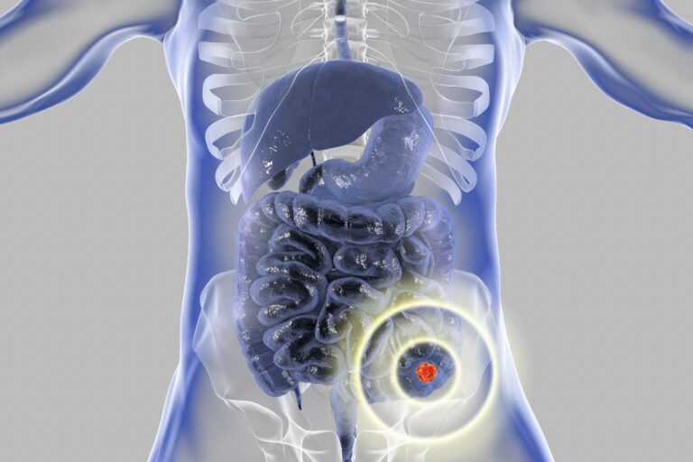 A second expansion phase assessing HC-7366/belzutifan in locally advanced/metastatic renal cell carcinoma is ongoing.