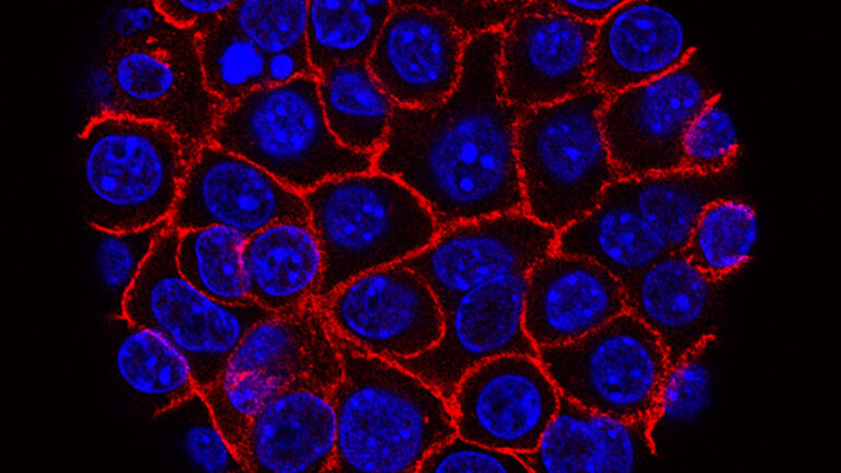 ‘Synthetic lethality’ could trigger another round of biotech M&A 'Synthetic lethality' could trigger another round of biotech M&A