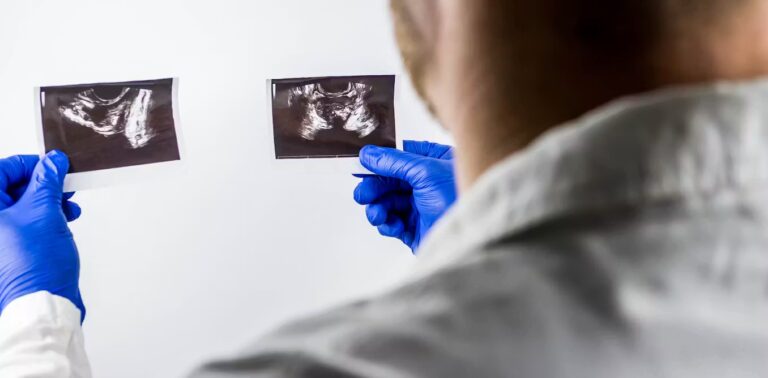 Why some men with prostate cancer may soon need only five radiotherapy sessions Why some men with prostate cancer may soon need only five radiotherapy sessions