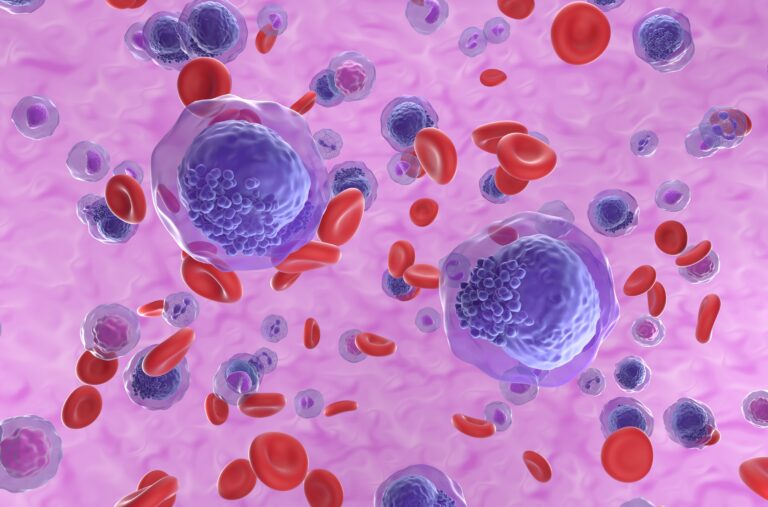 Burkitt's lymphoma cells, a cancer of the lymphatic system, monoclonal B-cell tumor, 3D illustration