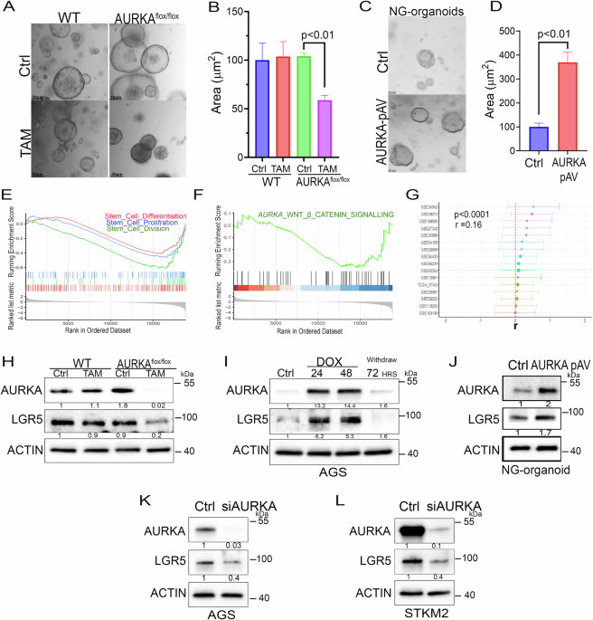 AURKA regulates LGR5 in response to Helicobacter Pylori infection by modulating its deubiquitination AURKA regulates LGR5 in response to Helicobacter Pylori infection by modulating its deubiquitination