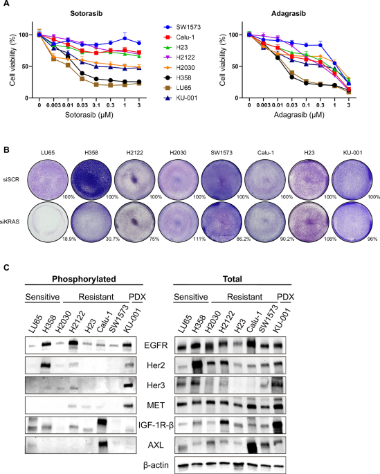 Amphiregulin-mediated EGFR activation drives both intrinsic and acquired resistance to KRAS G12C inhibitors in KRAS G12C–mutant non-small cell lung cancer Amphiregulin-mediated EGFR activation drives both intrinsic and acquired resistance to KRAS G12C inhibitors in KRAS G12C–mutant non-small cell lung cancer