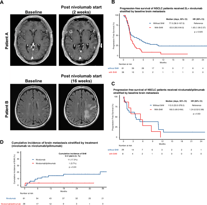 Anti-PD-1 plus anti-CTLA-4 blockade overcomes immune exclusion in NSCLC brain metastases by enhancing CD8+ T cell responses and promoting tertiary lymphoid structure formation Anti-PD-1 plus anti-CTLA-4 blockade overcomes immune exclusion in NSCLC brain metastases by enhancing CD8+ T cell responses and promoting tertiary lymphoid structure formation